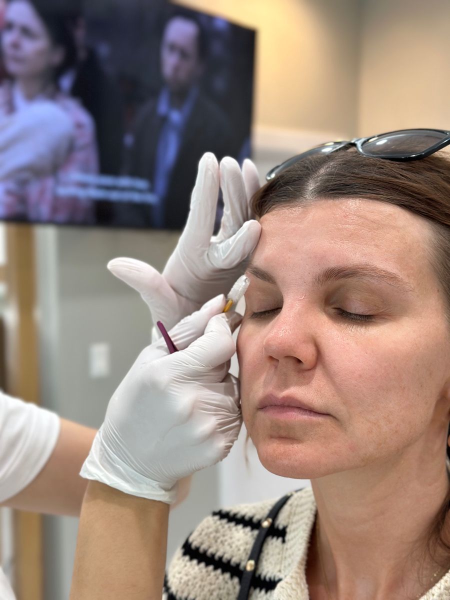 Brow lamination before after